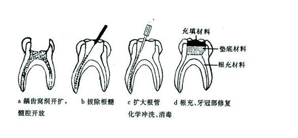 牙齒全瓷修復(fù)：美學(xué)與功能的和諧統(tǒng)一 | 成都義齒廠家